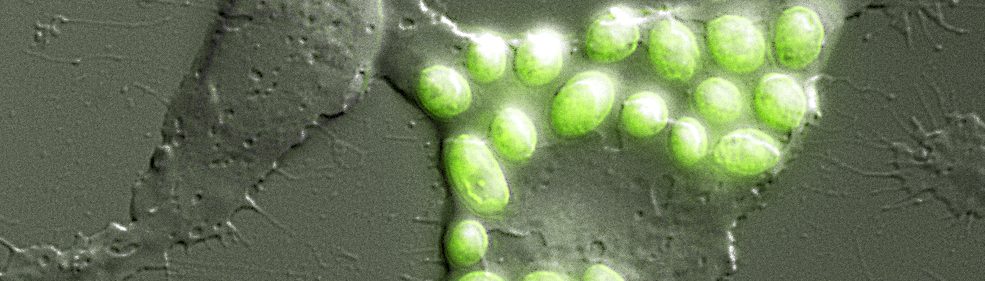 J774 macrophage with yeast particles
